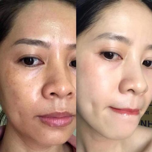 propolis-1000-serum-review-tu-nguoi-dung-co-thuc-su-than-thanh-nhu-loi-don2
